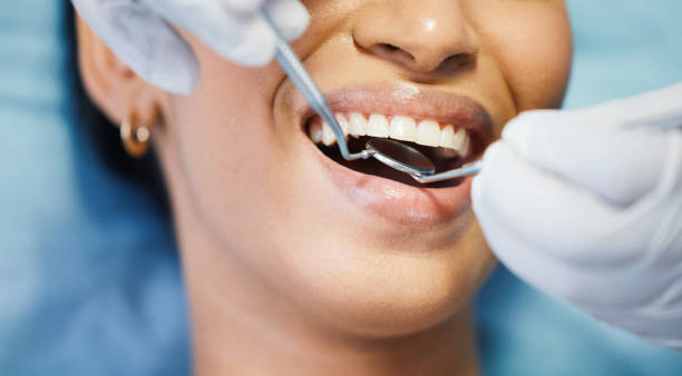 Best Emergency Broken Tooth Repair in Red Lodge, MT